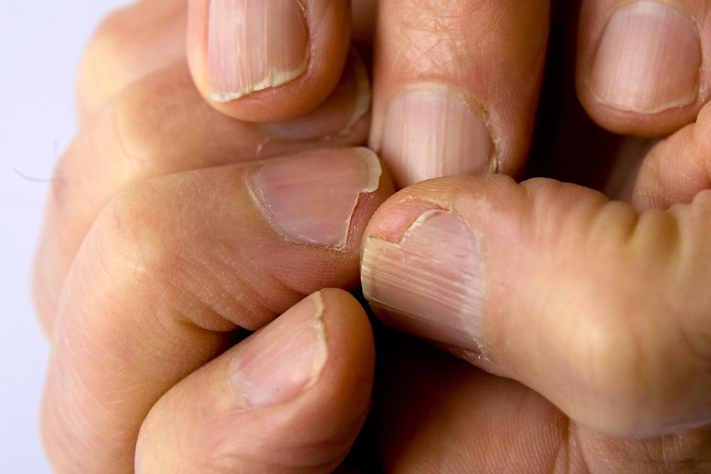 Nail surgery 